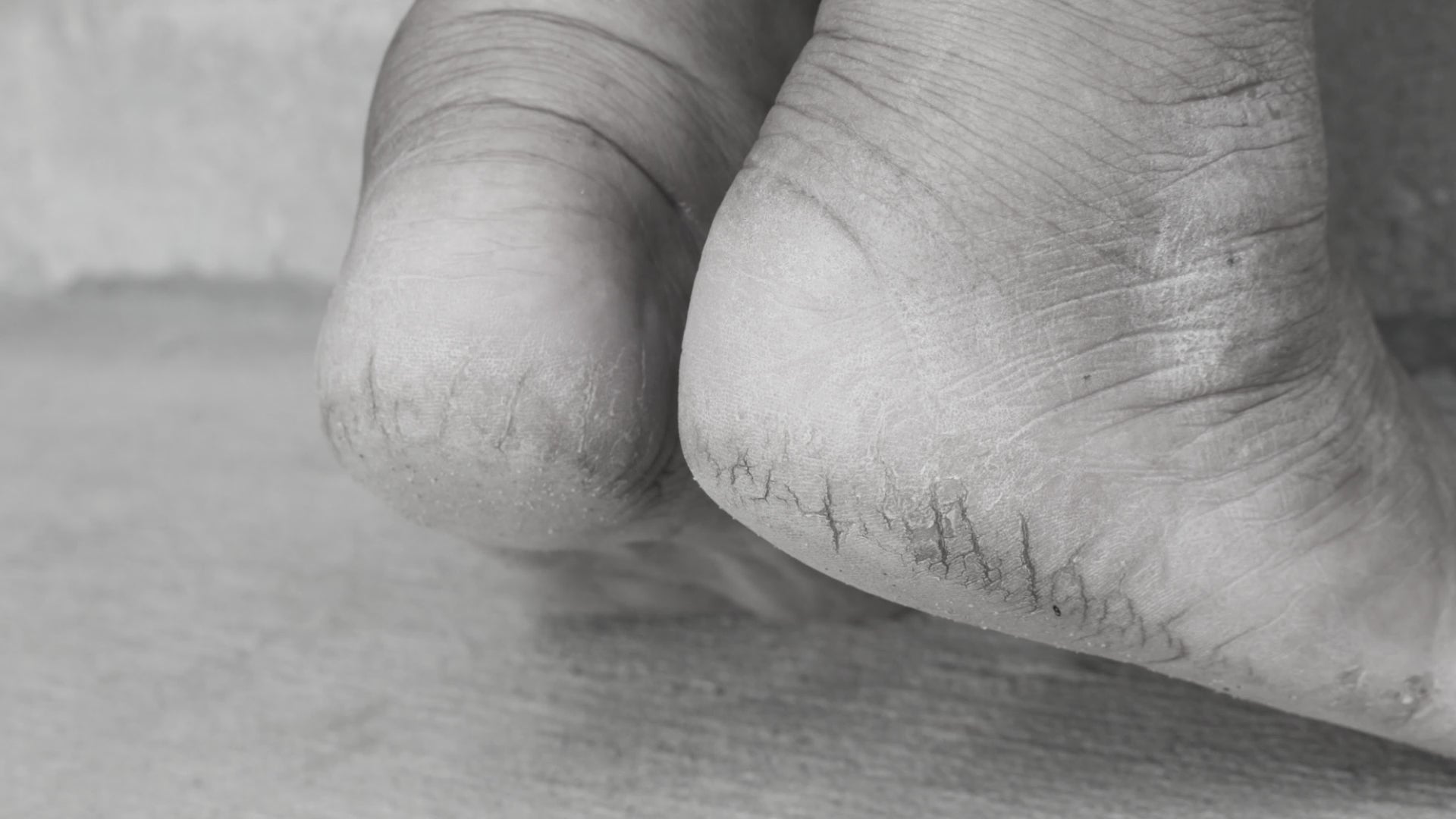 30HS - Crema per i Piedi con 30% di Urea - 200ml