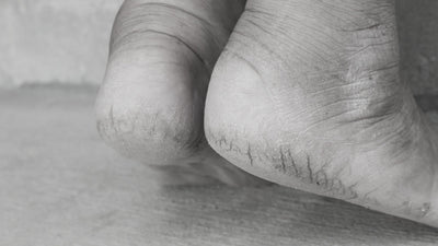 30HS - Crema per i Piedi con 30% di Urea - 200ml