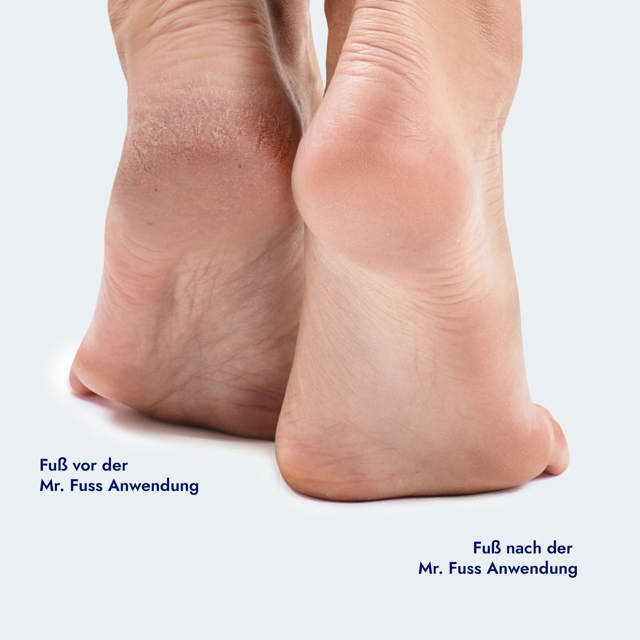 Starter Kit 2026 - Excell